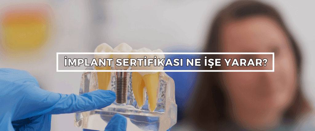 Implant Sertifikasi Ne Ise Yarar Implant Sertifikasi Ne Ise Yarar